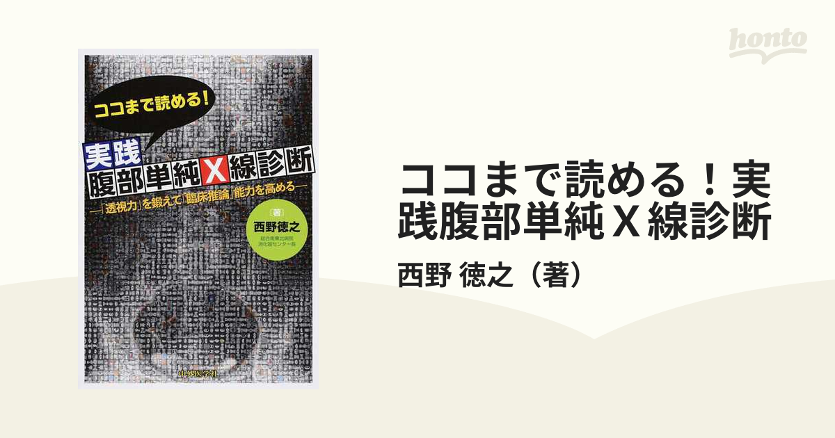 ココまで読める!実践腹部単純X線診断 「透視力」を鍛えて「臨床推論