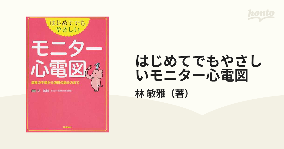 はじめてでもやさしい モニター心電図: 装着の手順から波形の読み方まで