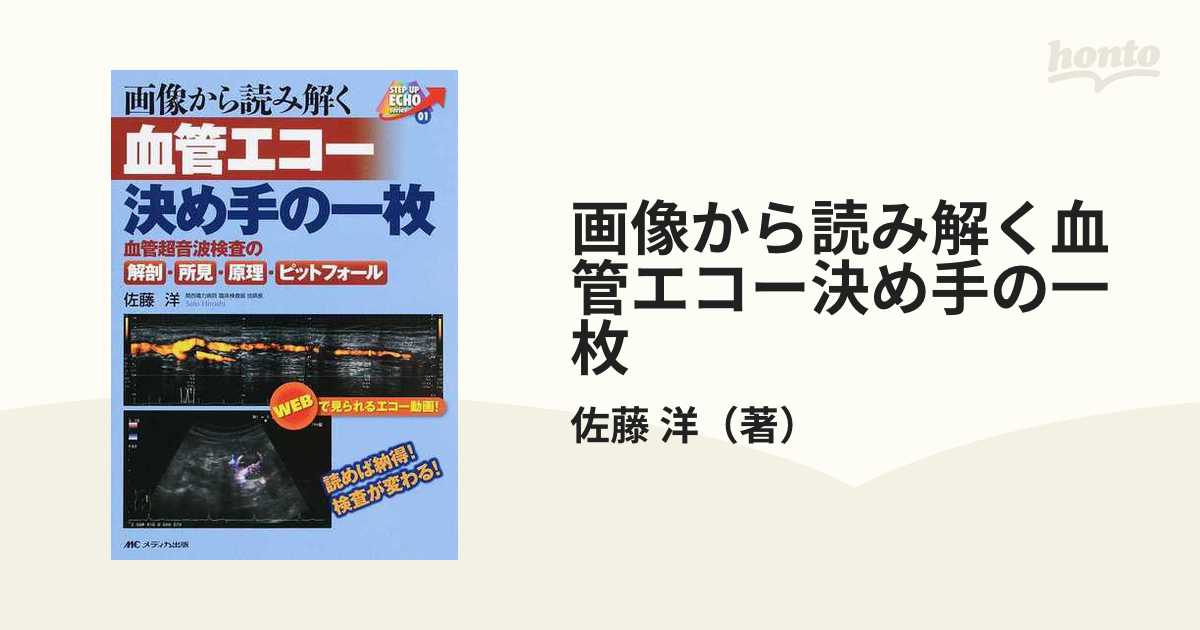 画像から読み解く血管エコー決め手の一枚 血管超音波検査の解剖・所見・原理・ピットフォール