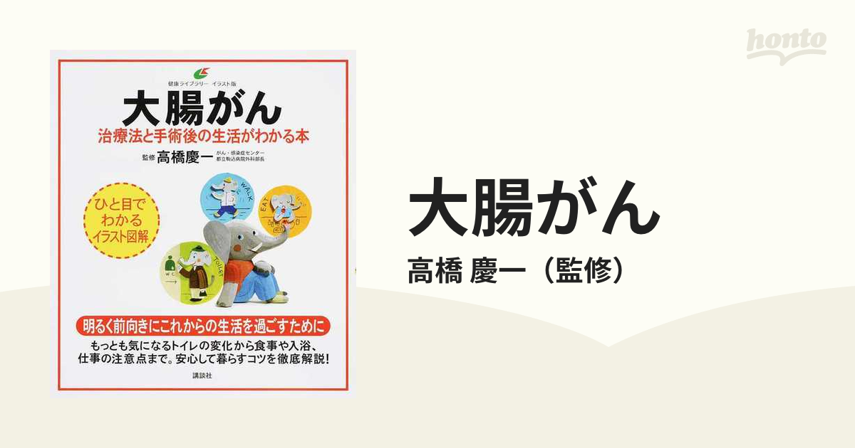 大腸がん 治療法と手術後の生活がわかる本 イラスト版