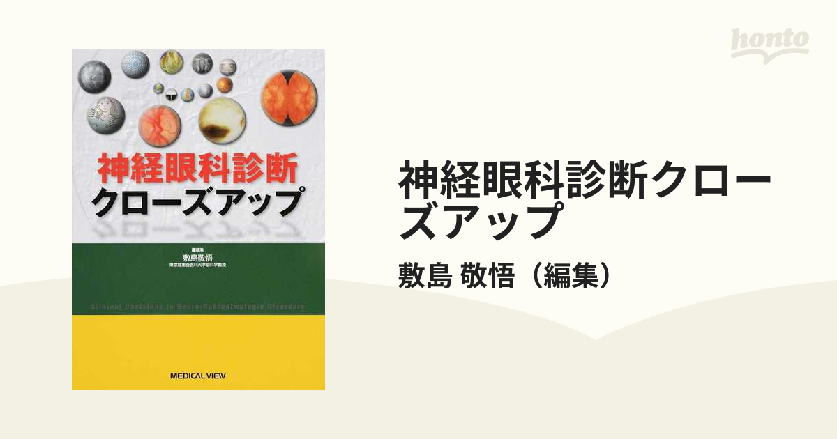 年間定番 裁断済み フローチャートでみる神経眼科診断