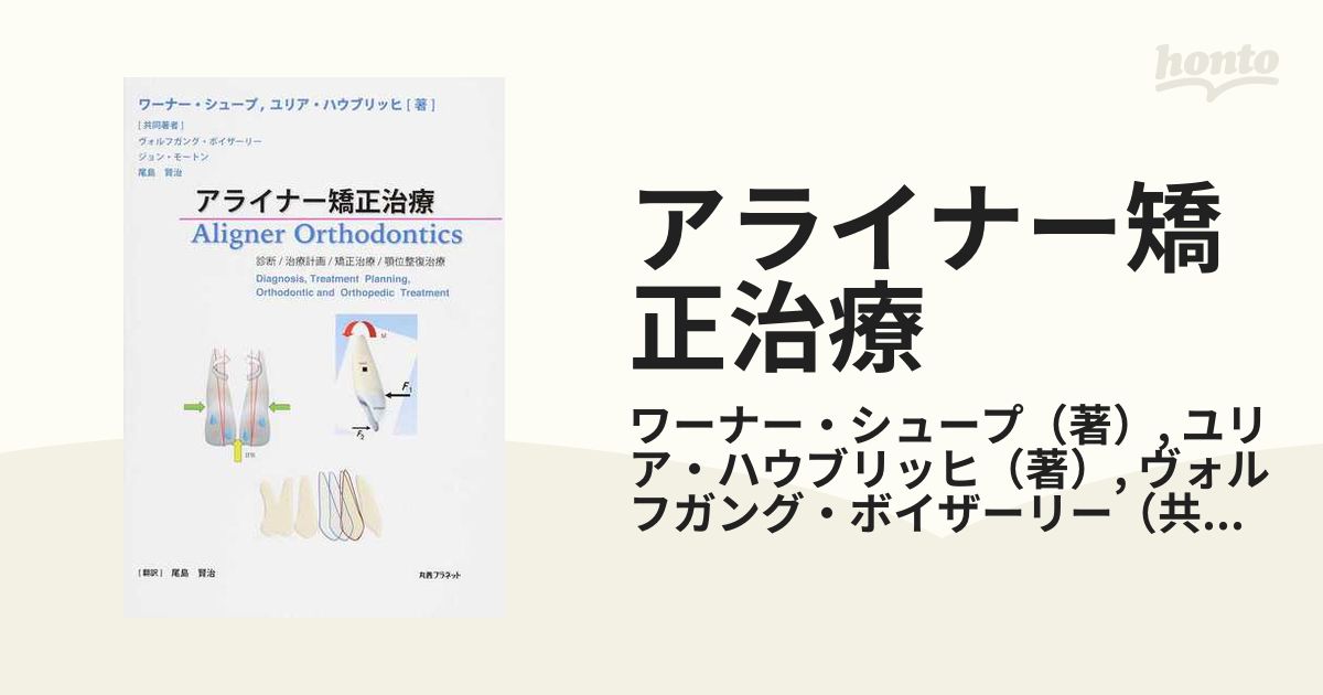 Amazon.co.jp: アライナー矯正治療 診断/治療計画/矯正治療/顎位