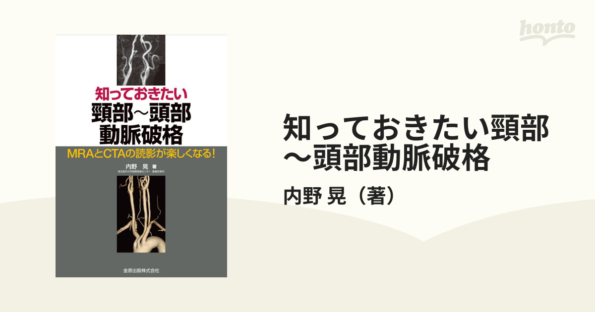 知っておきたい頸部〜頭部動脈破格 ＭＲＡとＣＴＡの読影が楽しくなる