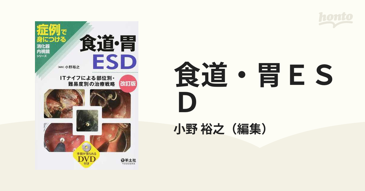 当店限定販売】 食道・胃ESD : ITナイフによる部位別・難易度別の治療 