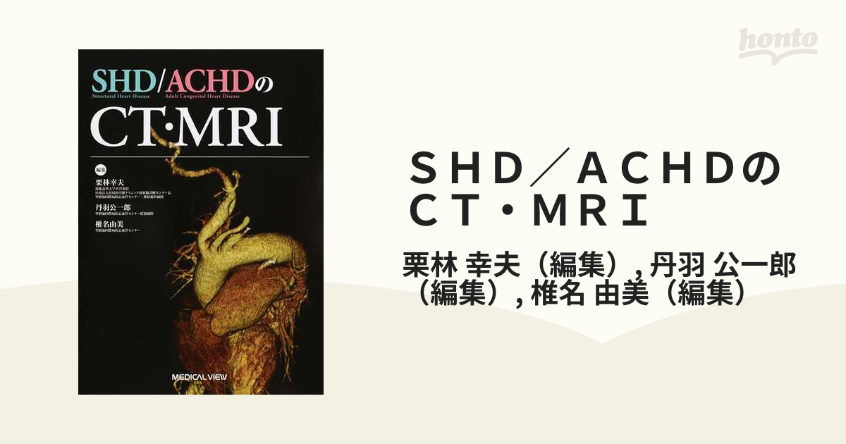 ＳＨＤ／ＡＣＨＤのＣＴ・ＭＲＩの通販/栗林 幸夫/丹羽 公一郎 - 紙の