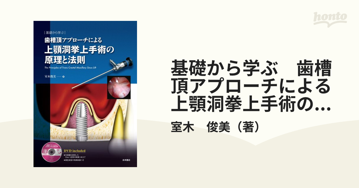 基礎から学ぶ 歯槽頂アプローチによる上顎洞挙上手術の原理と法則 ─The Principles of Trans Crestal Maxillary Sinus Lift─ 基礎から学ぶ 歯槽頂アプローチによる上顎洞挙上手術の原理と