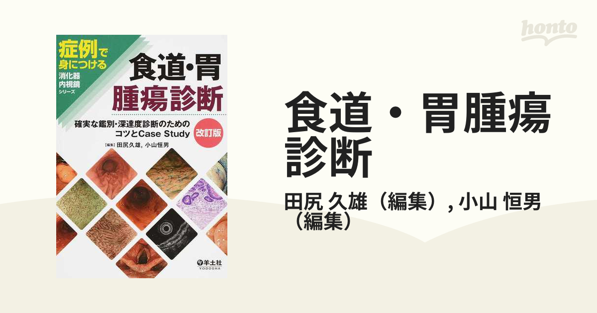 送料無料】本/食道・胃腫瘍診断 確実な鑑別・深達度診断のためのコツと