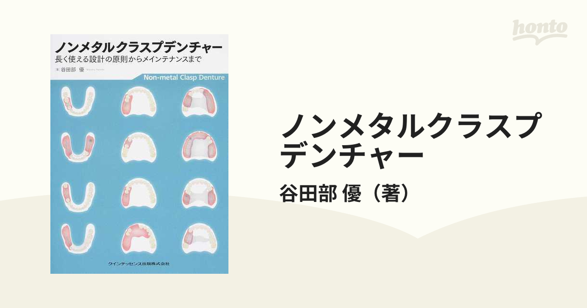 ノンメタルクラスプデンチャー 長く使える設計の原則からメインテナンスまで