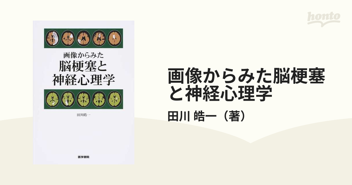 裁断済み 脳血管障害と神経心理学 第二版 - 健康・医学