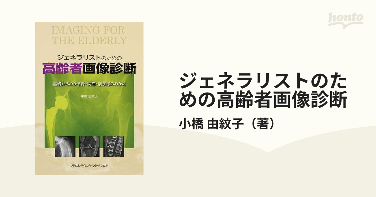 ジェネラリストのための高齢者画像診断 基礎からわかる骨・関節・筋疾患のみかた