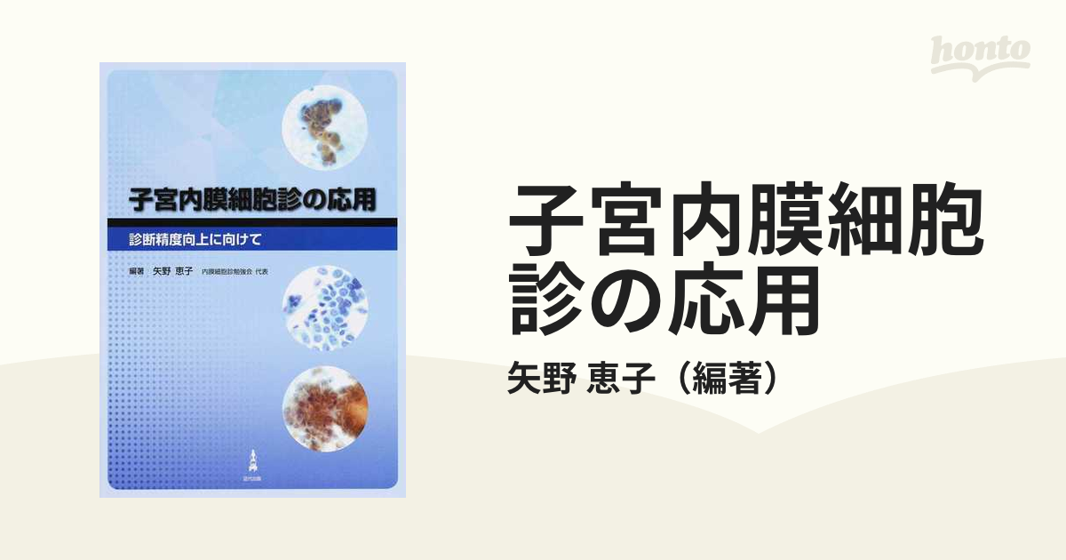 子宮内膜細胞診の応用 診断精度向上に向けての通販/矢野 恵子 - 紙の本