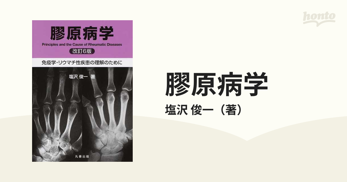 膠原病学 免疫学・リウマチ性疾患の理解のために 改訂６版