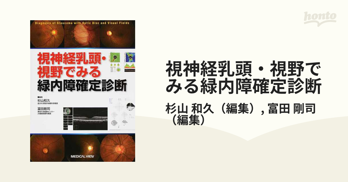 視神経乳頭・視野でみる緑内障確定診断 / 杉山和久 富田 剛司 D02008 