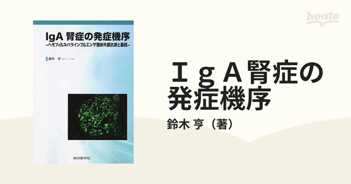 IgA腎症の発症機序 ヘモフィルス・パラインフルエンザ菌体外膜抗原と扁桃