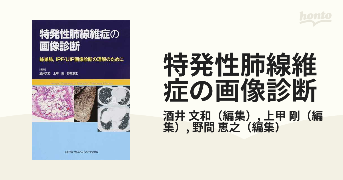  特発性間質性肺炎 診断と治療の手引き2022(改訂第4版)   日本呼吸器学会びまん性肺疾患診断・治療ガイドライン作成委員会  