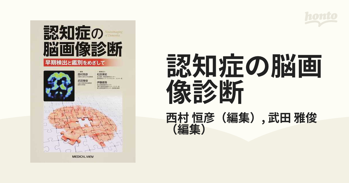 認知症の脳画像診断 早期検出と鑑別をめざして