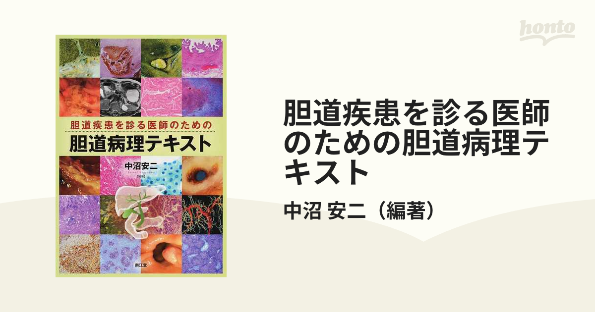 胆道疾患を診る医師のための胆道病理テキストの通販/中沼 安二 - 紙の