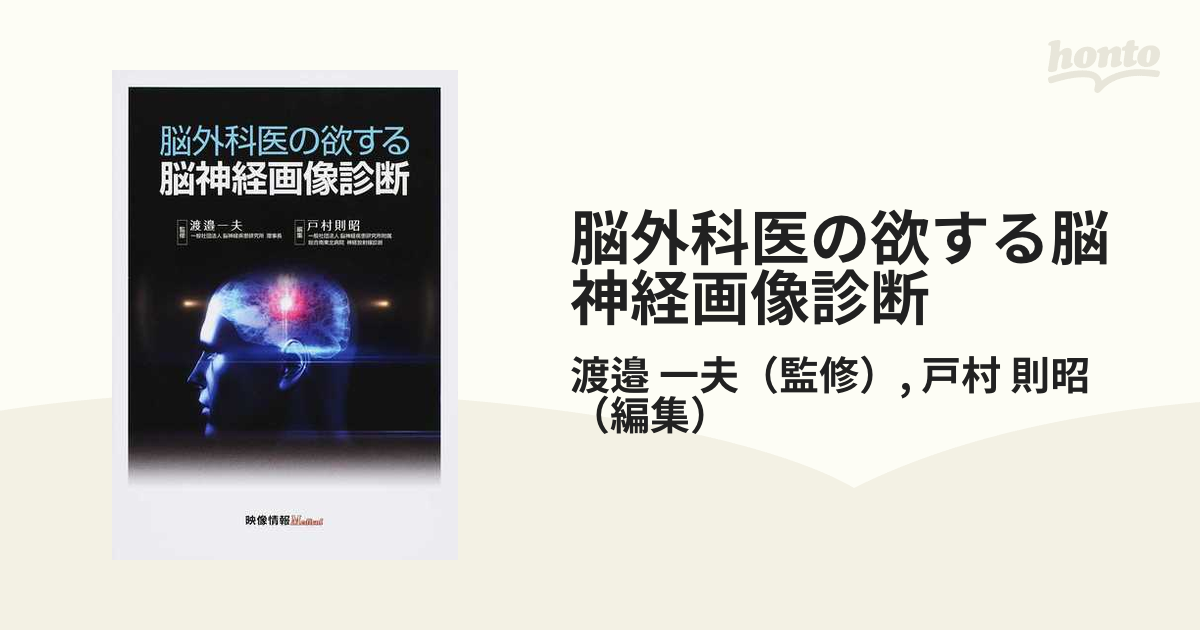 脳外科医の欲する脳神経画像診断の通販/渡邉 一夫/戸村 則昭 - 紙の本 ...