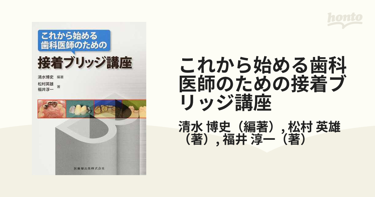 これから始める歯科医師のための接着ブリッジ講座