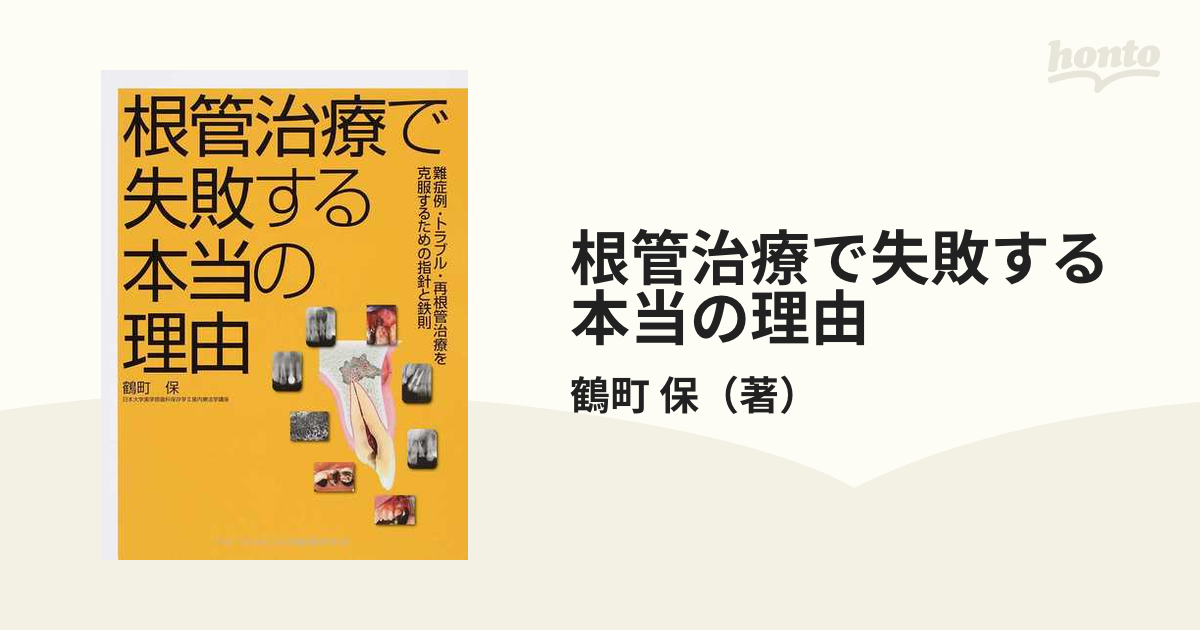 根管治療で失敗する本当の理由 難症例・トラブル・再根管治療を克服するための指針と鉄則