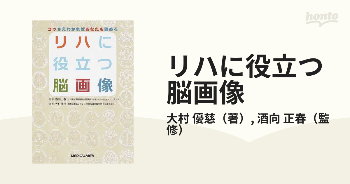 リハに役立つ脳画像 コツさえわかればあなたも読める