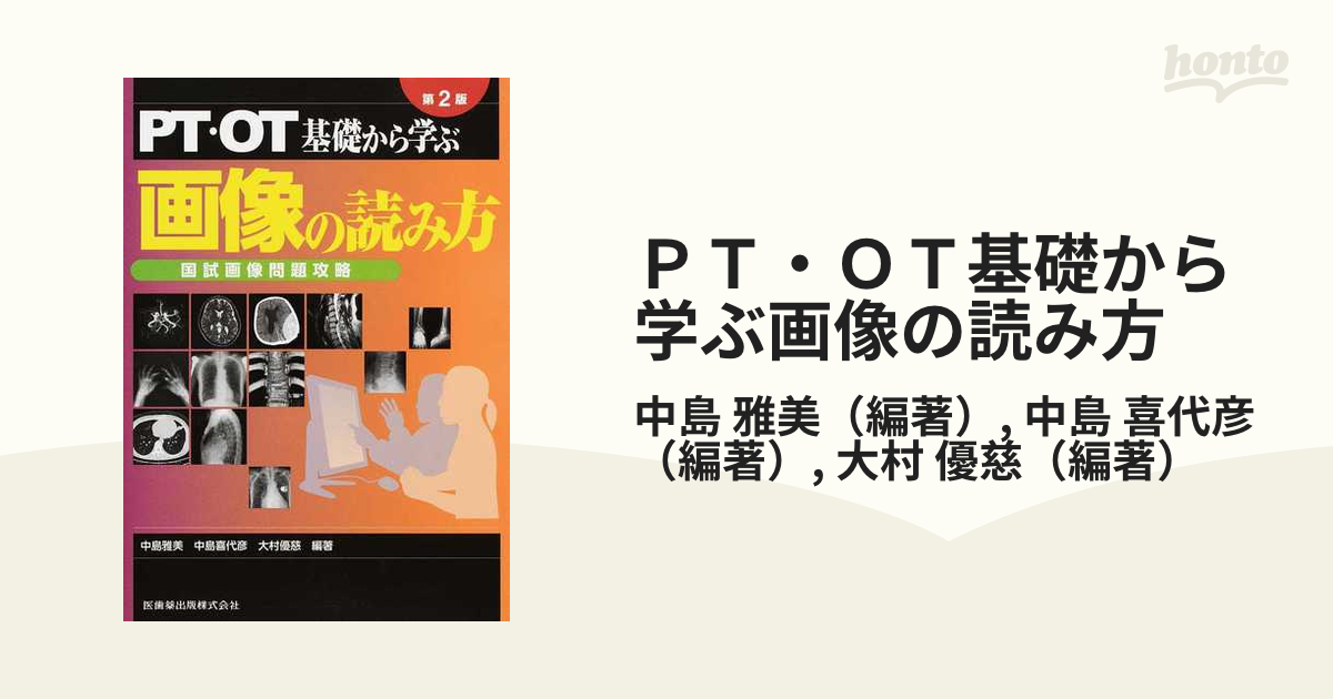 ＰＴ・ＯＴ基礎から学ぶ画像の読み方 国試画像問題攻略 第２版