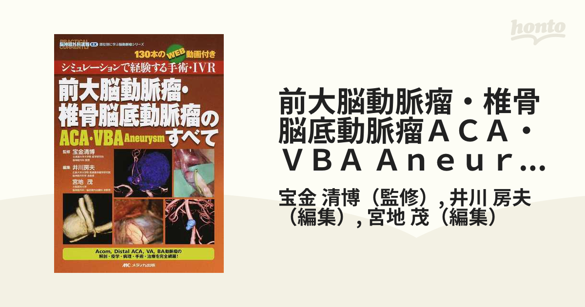 前大脳動脈瘤・椎骨脳底動脈瘤 (ACA・VBA Aneurysm) のすべて-