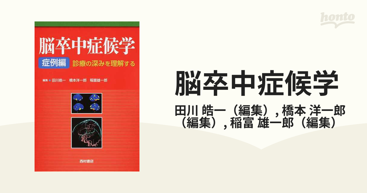【裁断済】脳卒中症候学 症例編 Amazon.co.jp: 脳卒中症候学 症例編: 診療の深みを理解する