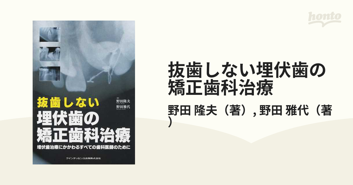 抜歯しない埋伏歯の矯正歯科治療 埋伏歯治療にかかわるすべての歯科医師のために