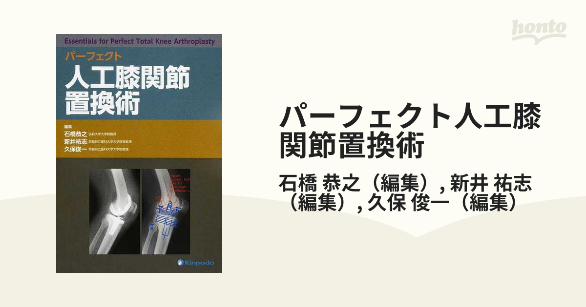 パーフェクト 人工膝関節置換術