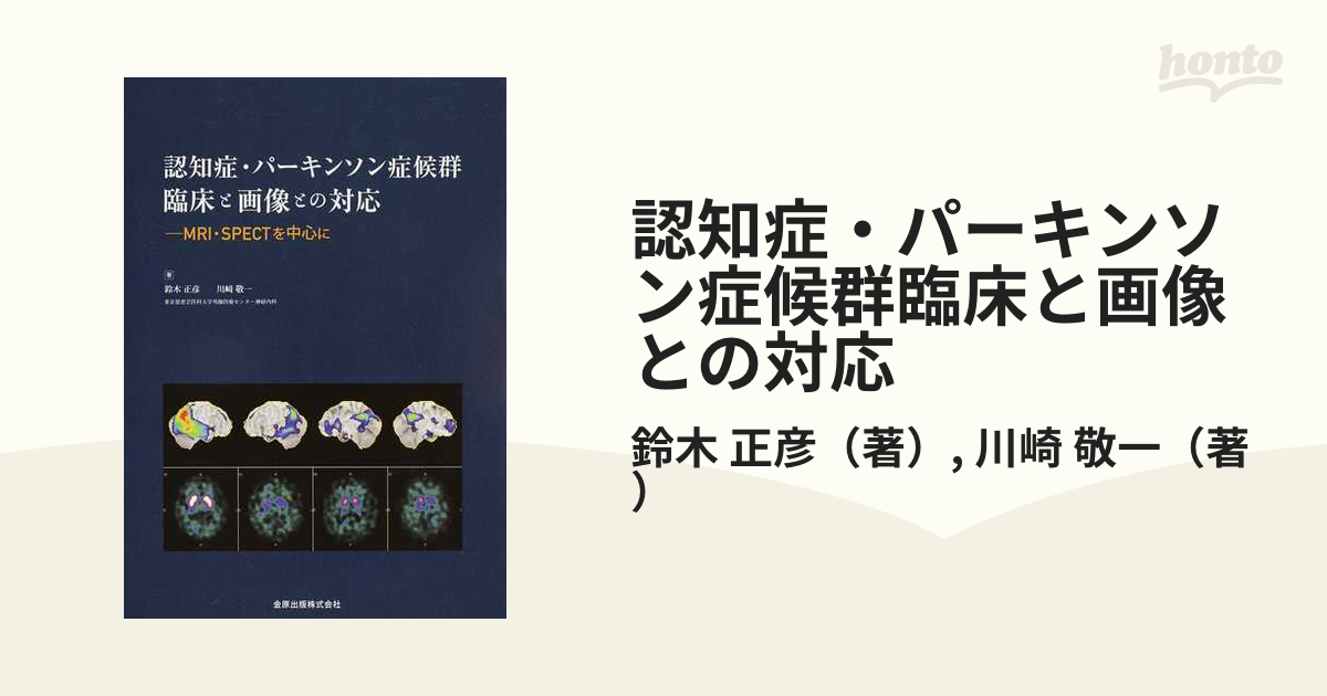 認知症・パーキンソン症候群 臨床と画像との対応 MRI ・SPECT 裁断済み 