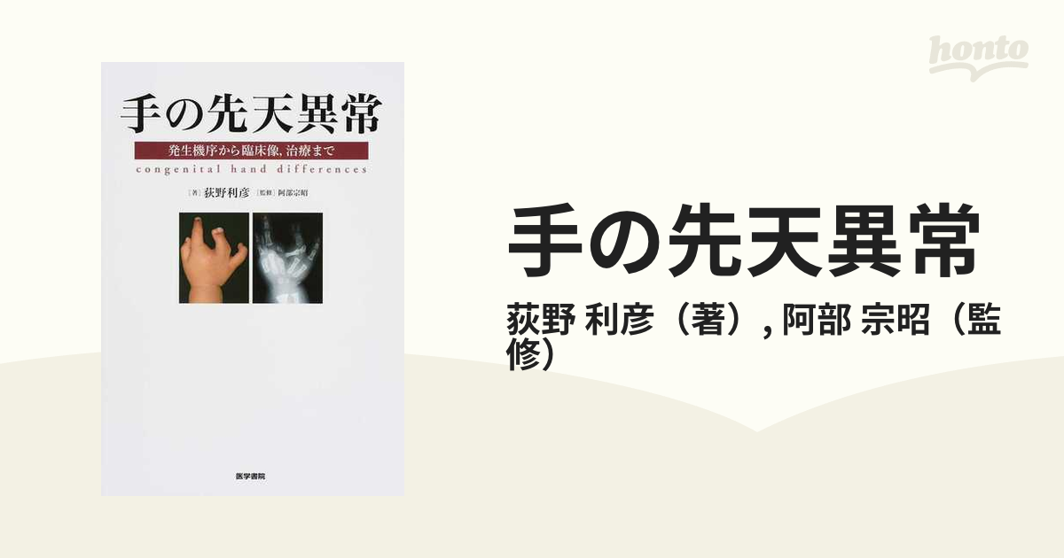 荻野_利彦手の先天異常 発生機序から臨床像,治療まで