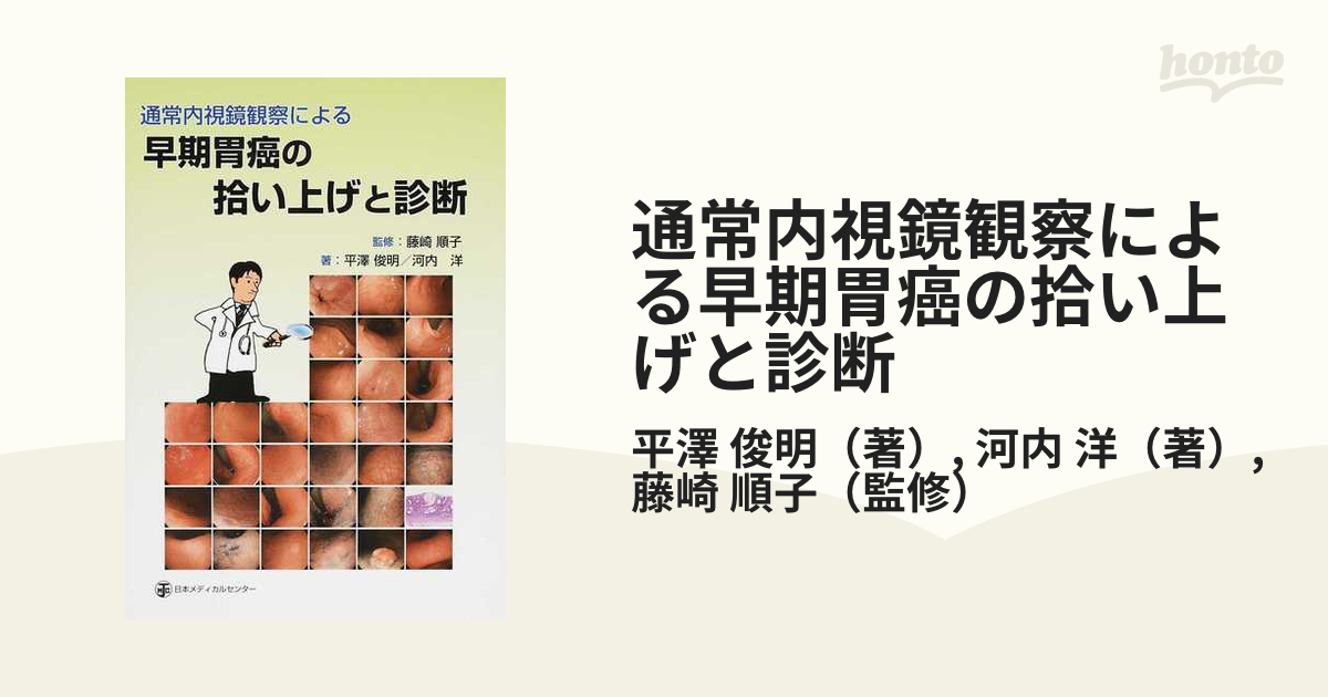 通常内視鏡観察による早期胃癌の拾い上げと診断 [単行本] 平澤 俊明、 河内 洋; 藤崎 順子