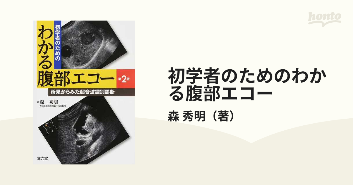 初学者のためのわかる腹部エコー 所見からみた超音波鑑別診断 第２版