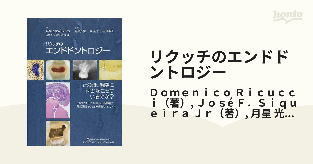 リクッチのエンドドントロジー その時，歯髄に何が起こっているのか？ 世界でもっとも美しい組織像と臨床画像でわかる最新のエンド