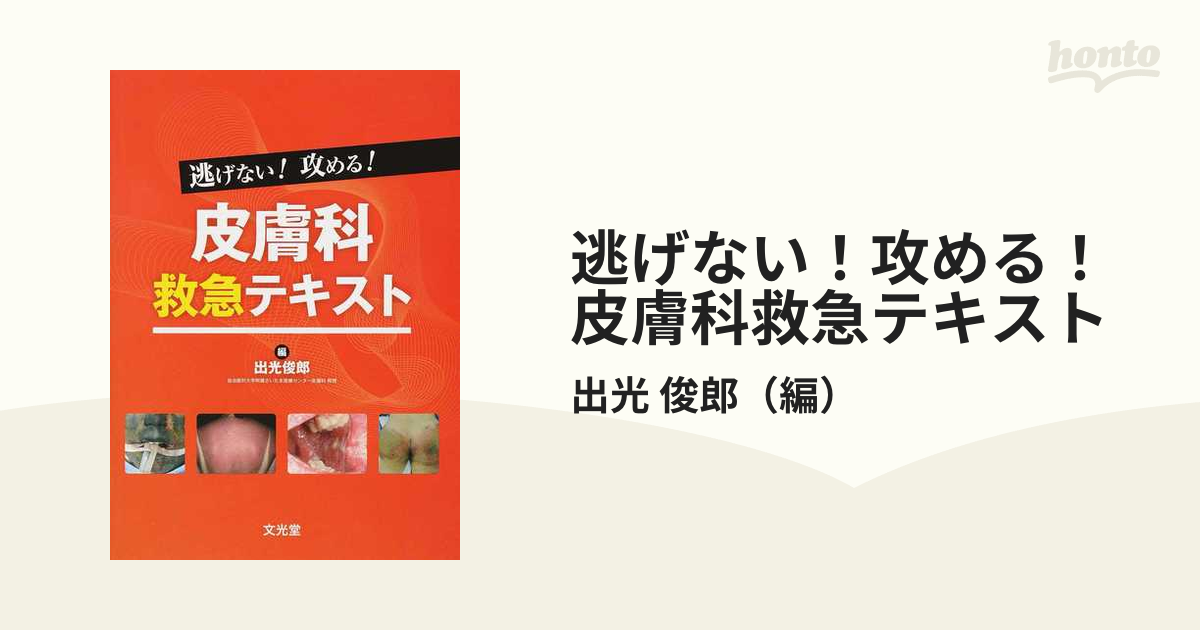 逃げない！攻める！皮膚科救急テキストの通販/出光 俊郎 - 紙の本