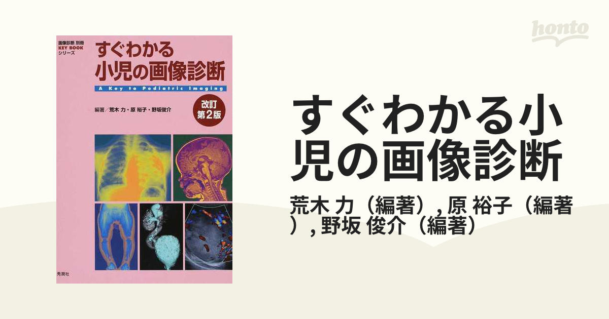 すぐわかる小児の画像診断 改訂第２版