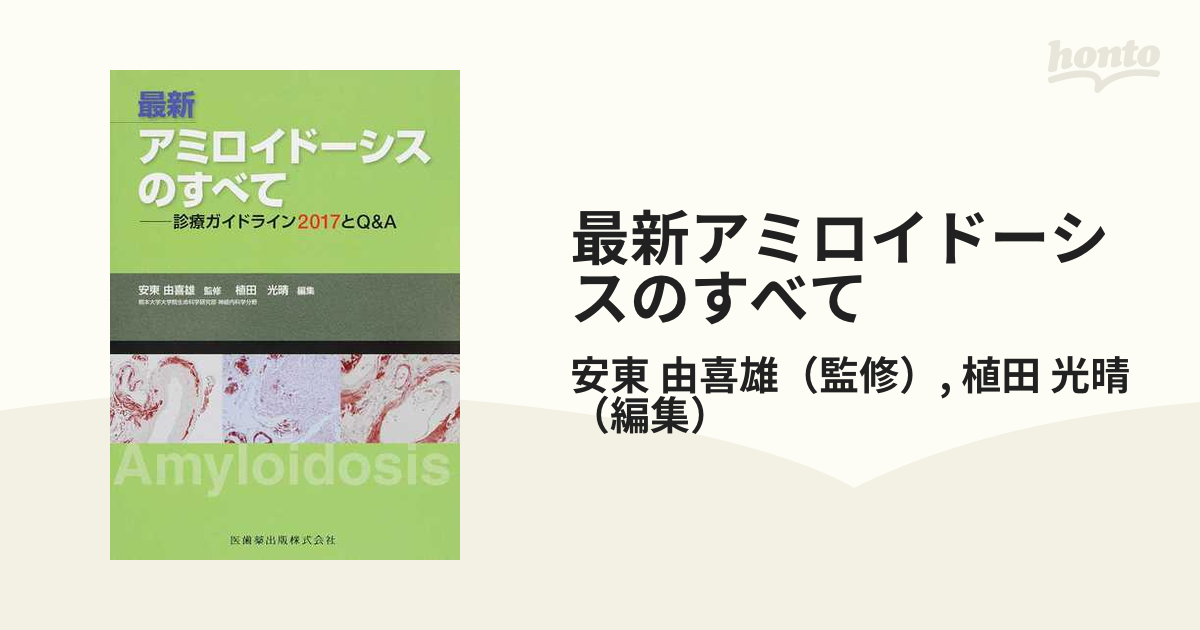 最新アミロイドーシスのすべて 診療ガイドライン２０１７とＱ＆Ａ