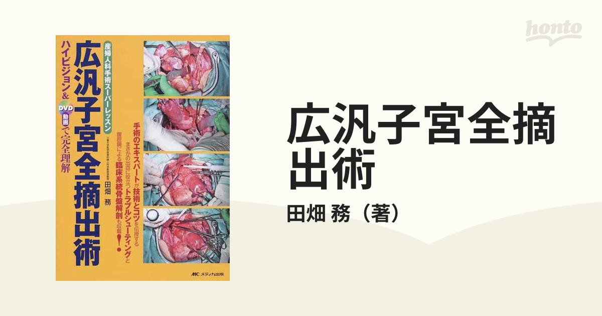 11 産業・研究開発用品 広汎子宮全摘出術 DVD付き
