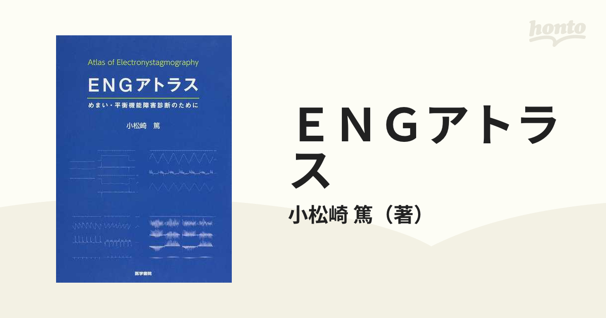 ENGアトラス めまい・平衡機能障害診断のために / 小松崎篤/著-