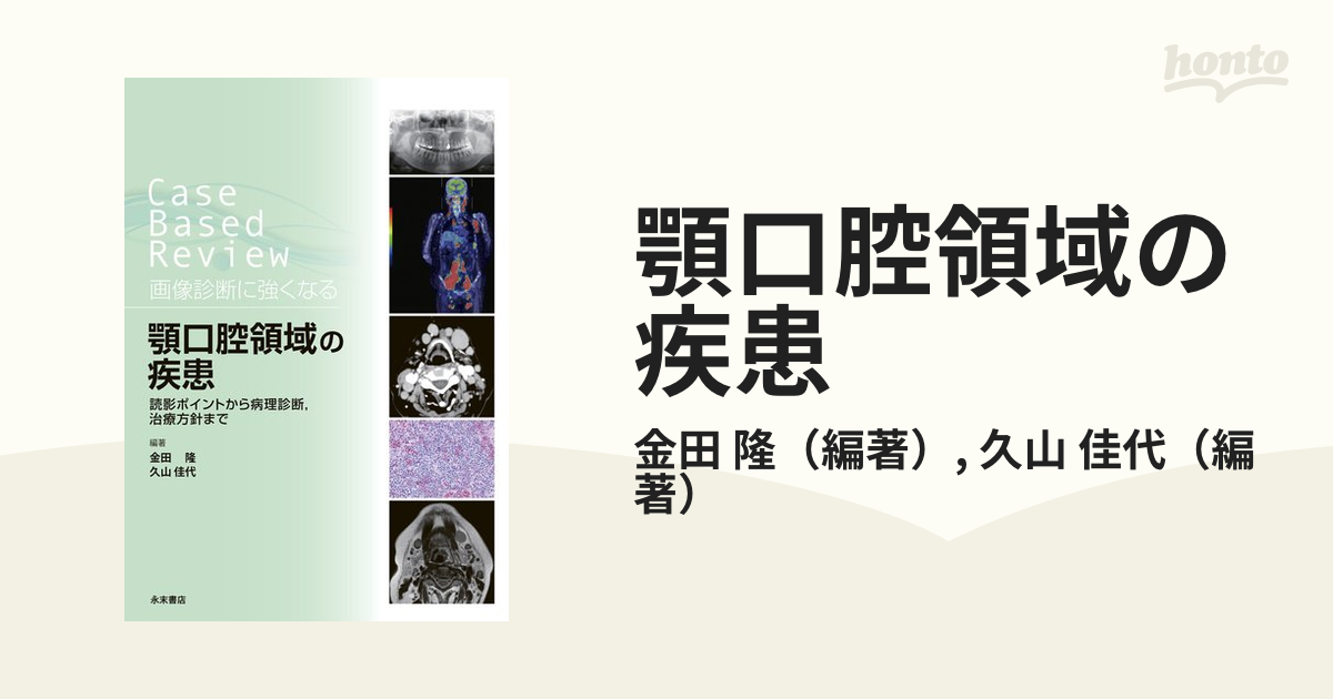 顎口腔領域の疾患 Ｃａｓｅ Ｂａｓｅｄ Ｒｅｖｉｅｗ画像診断に強くなる 読影ポイントから病理診断，治療方針まで