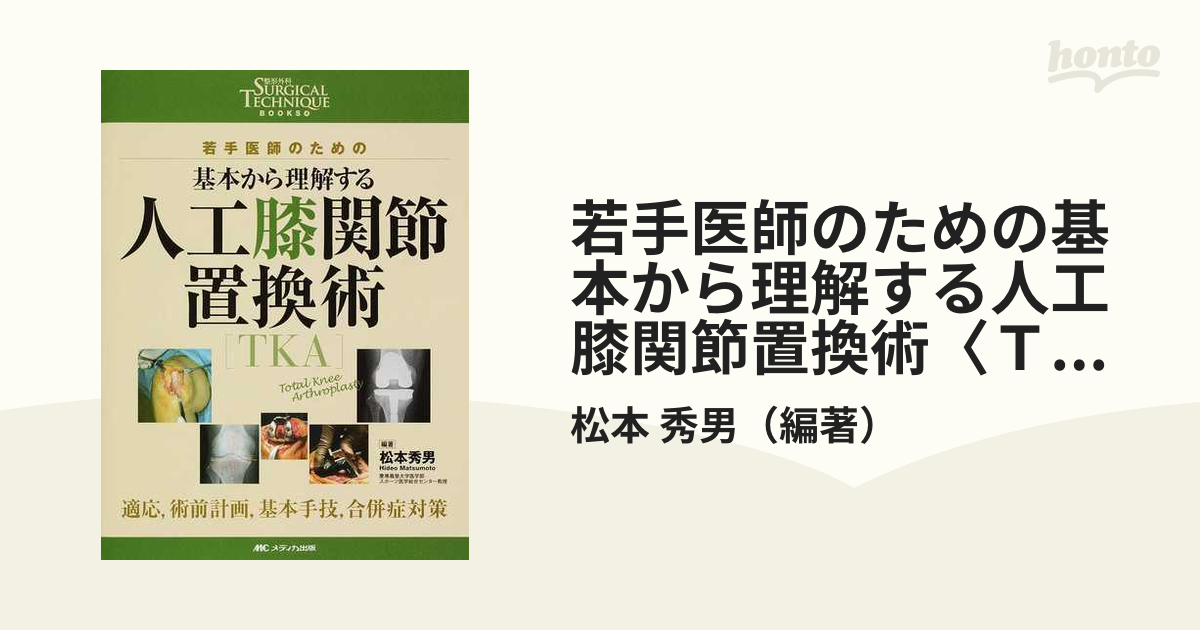 若手医師のための基本から理解する人工膝関節置換術〈ＴＫＡ〉 適応，術前計画，基本手技，合併症対策