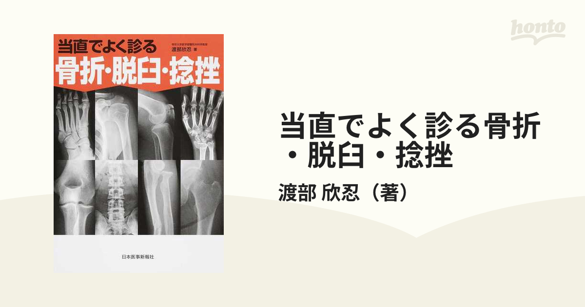 当直でよく診る骨折・脱臼・捻挫 - 健康・医学