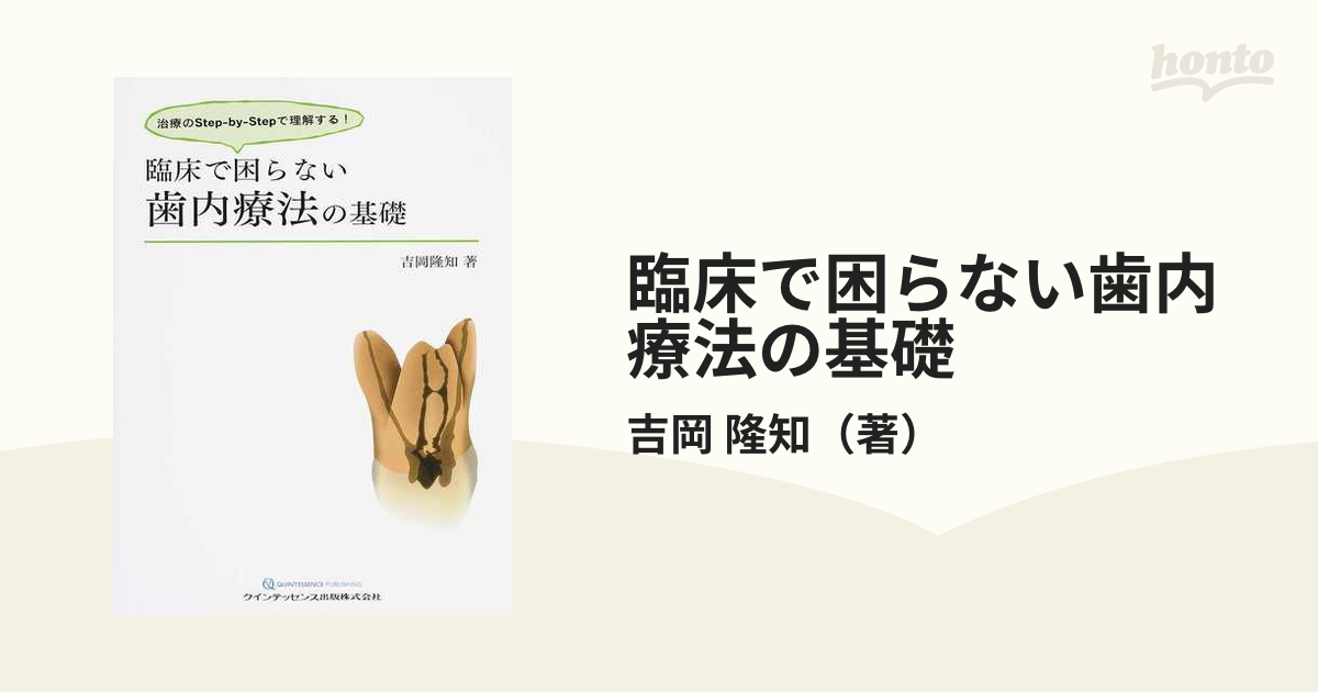 臨床で困らない歯内療法の基礎 治療のStep-by-Stepで理解