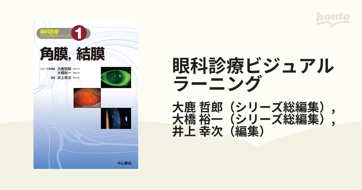 眼科診療ビジュアルラーニング ６ 大鹿 哲郎