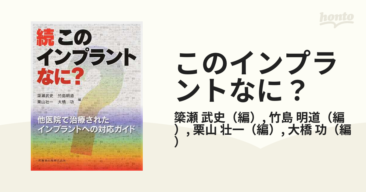 このインプラントなに? : 他医院で治療されたインプラントへの