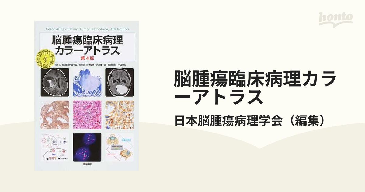 脳腫瘍臨床病理カラーアトラス　第４版　日本脳腫瘍病理学会