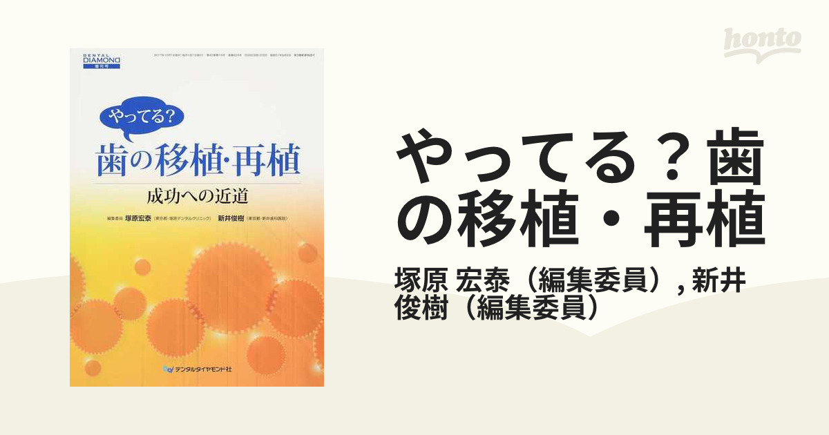 やってる？歯の移植・再植 成功への近道