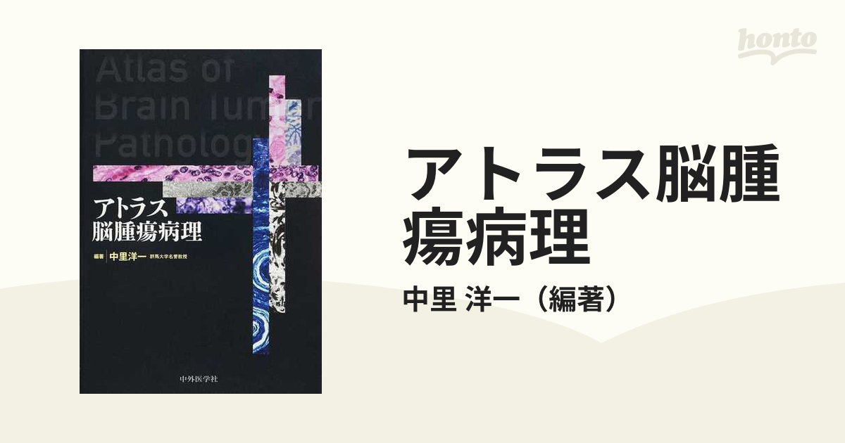 アトラス脳腫瘍病理の通販/中里 洋一 - 紙の本：honto本の通販ストア