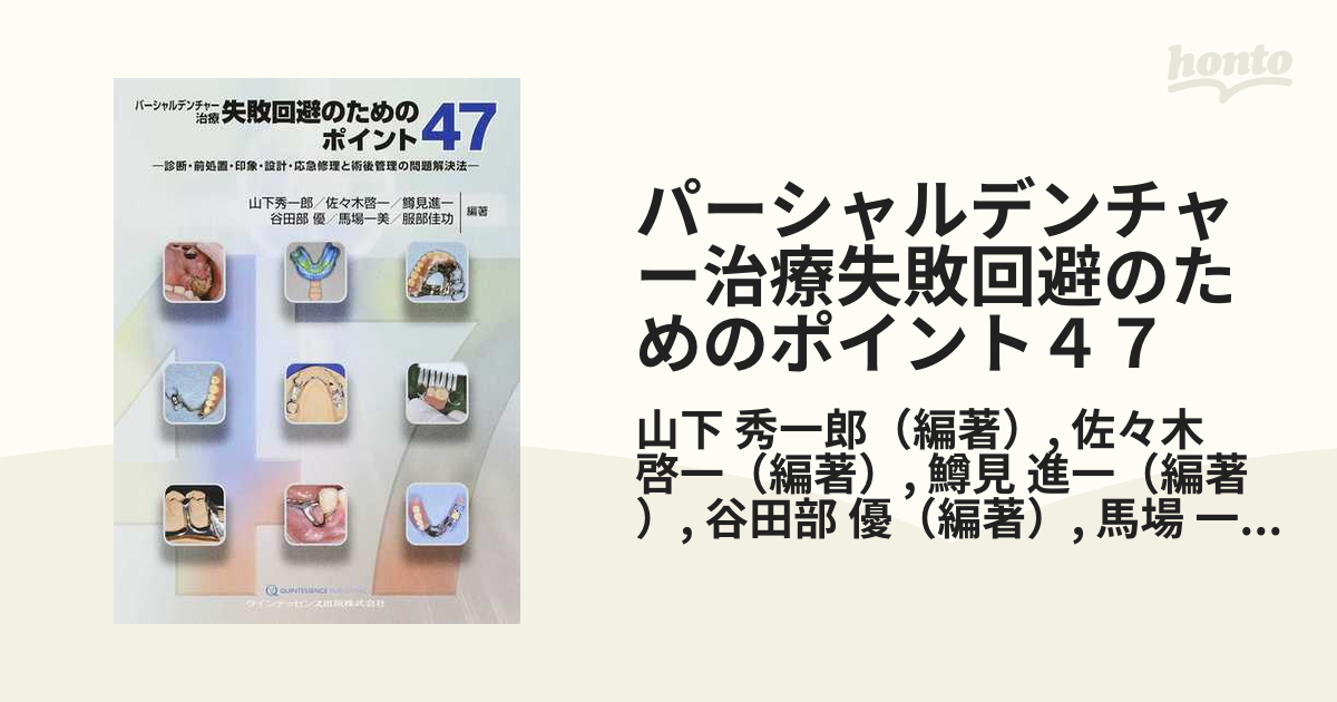 パーシャルデンチャー治療失敗回避のためのポイント４７ 診断・前処置・印象・設計・応急修理と術後管理の問題解決法